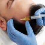 The Art of Hair Restoration