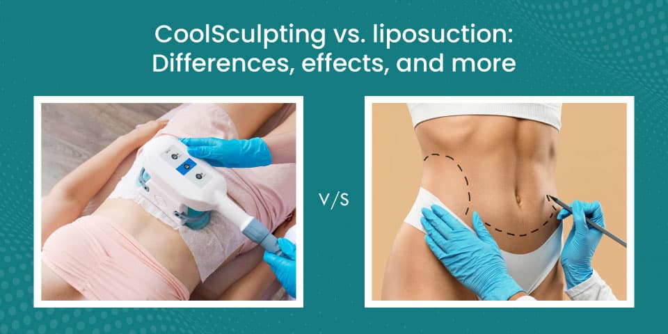 CoolSculpting vs. liposuction Differences, effects, and more