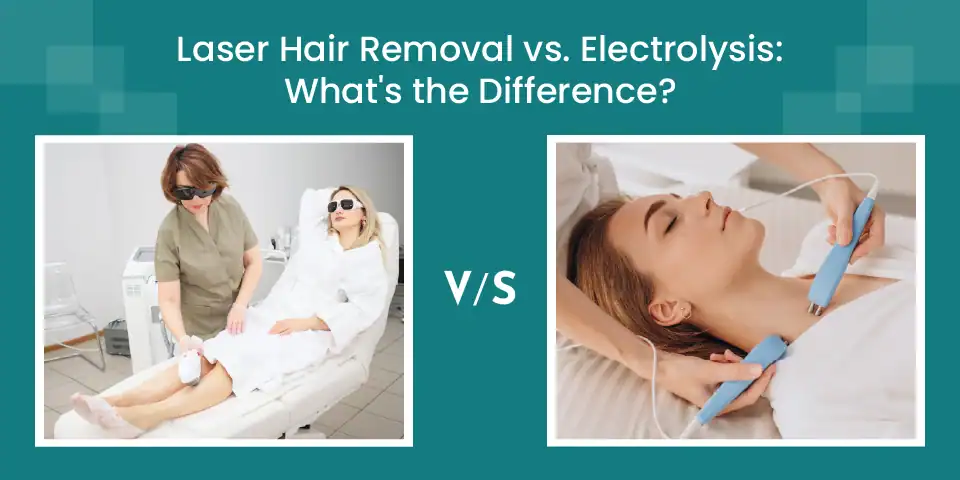 Laser Hair Removal vs. Electrolysis What's the Difference