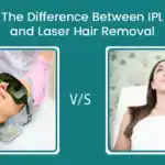 IPL vs Laser Hair Removal