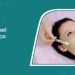 Laser Treatments for Face