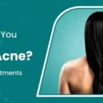 How Can You Get Rid of Back Acne