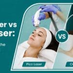 Pico Laser vs. CO₂ Laser for Skin